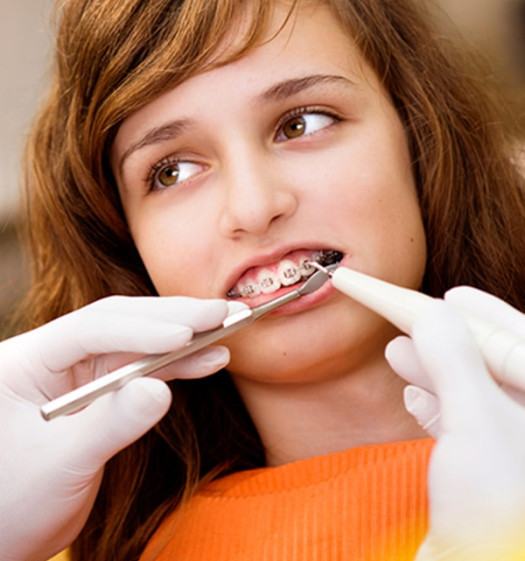 Прием стоматолога-ортодонта
